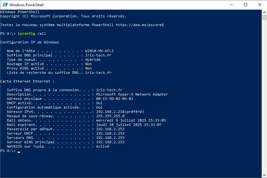 ipconfig